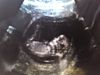 Benutzeravatar